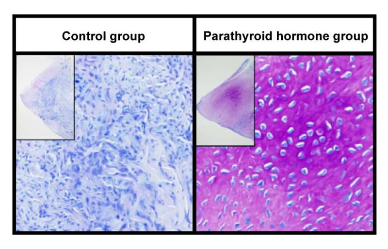 El tejido tendinoso más la hormona paratiroidea reproduce un menisco normal