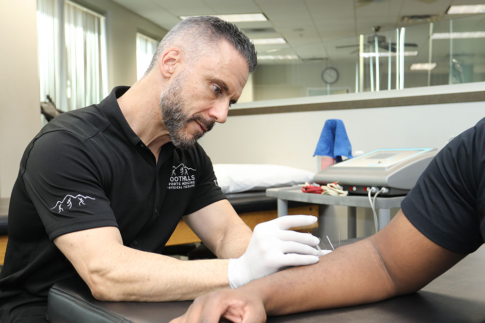 Terapeuta usando tratamiento de punción seca para el dolor de brazo.